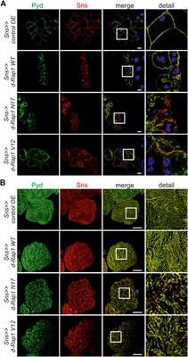 Rap1 Activity Is Essential for Focal Adhesion and Slit Diaphragm Integrity